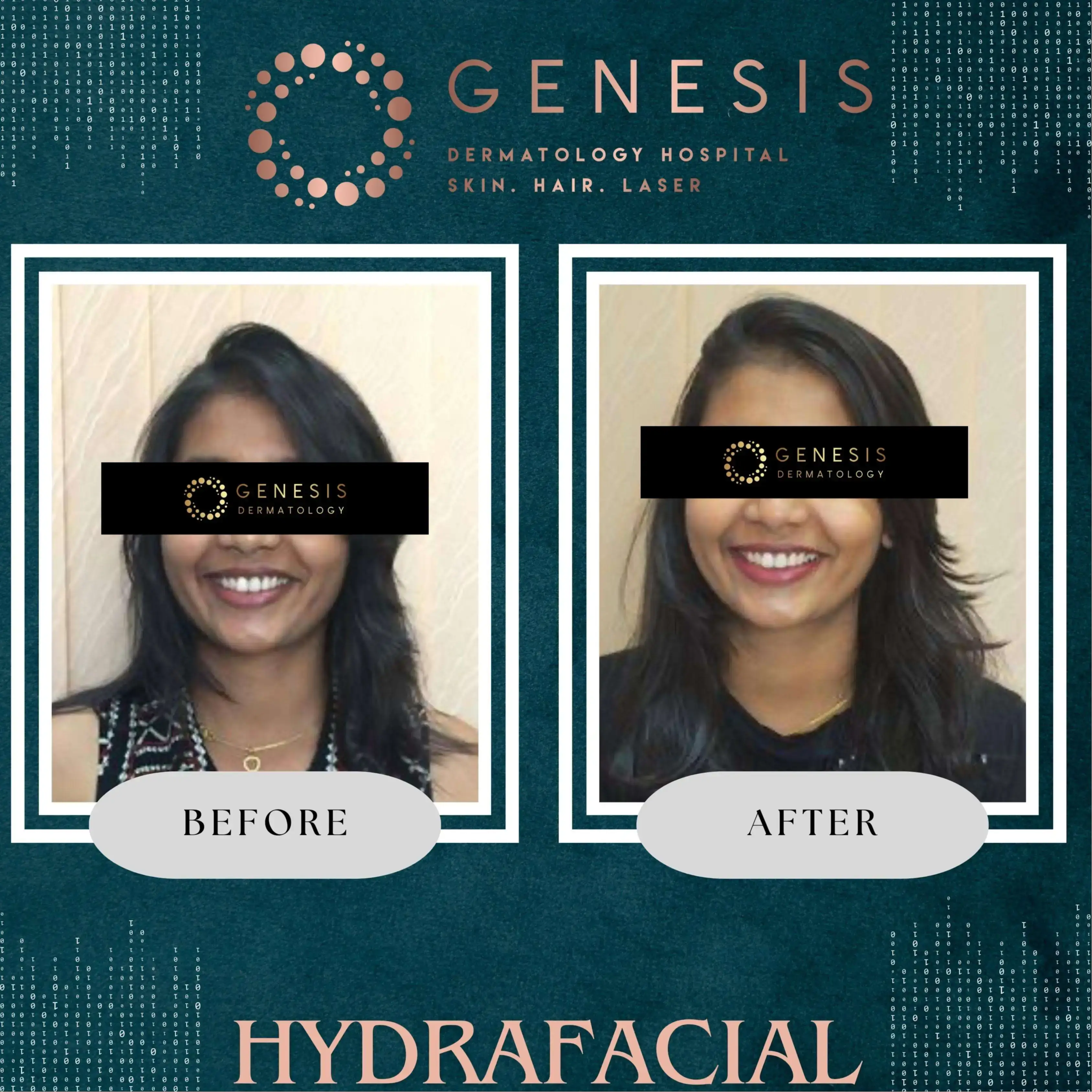 PRP Hair Treatment