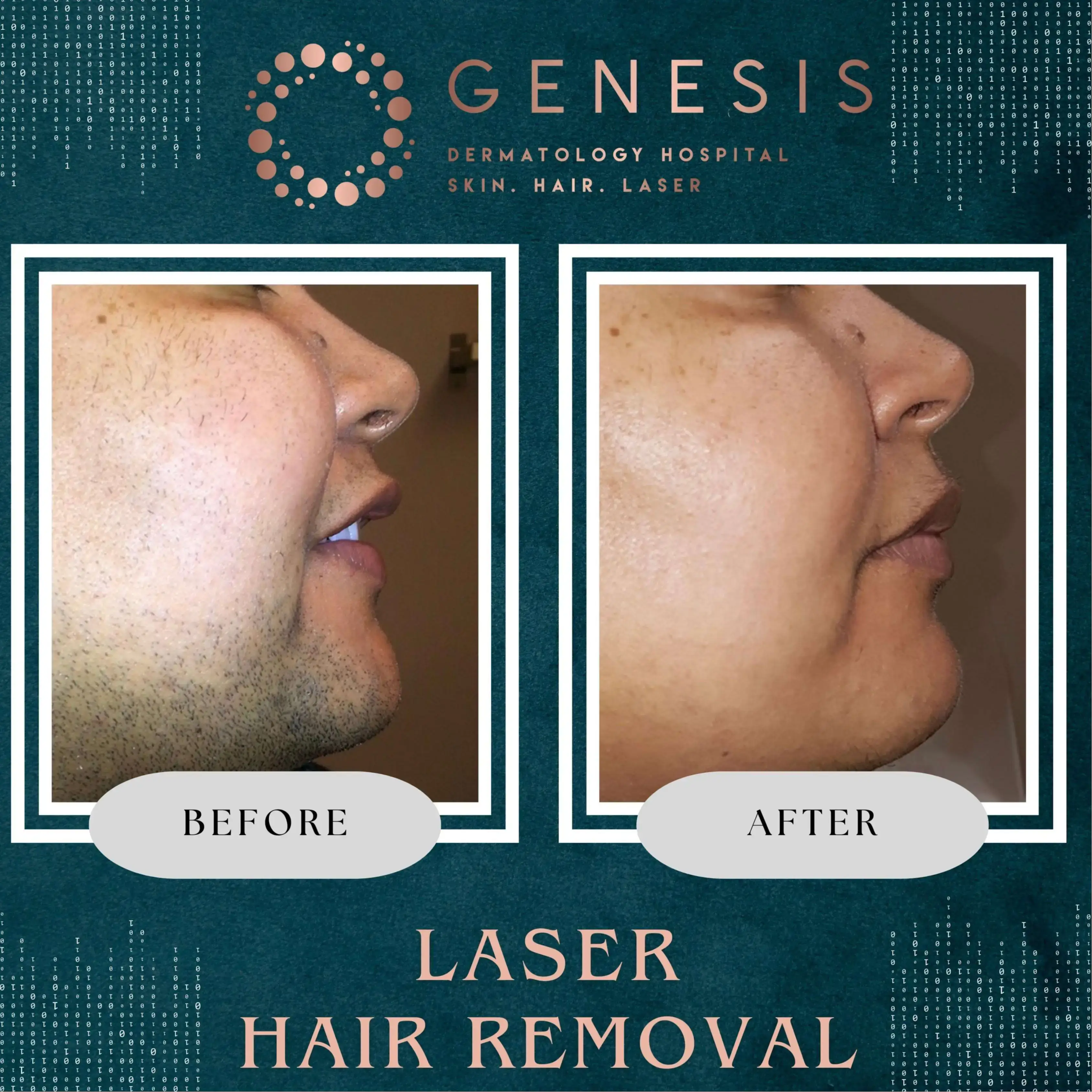 PRP Hair Treatment