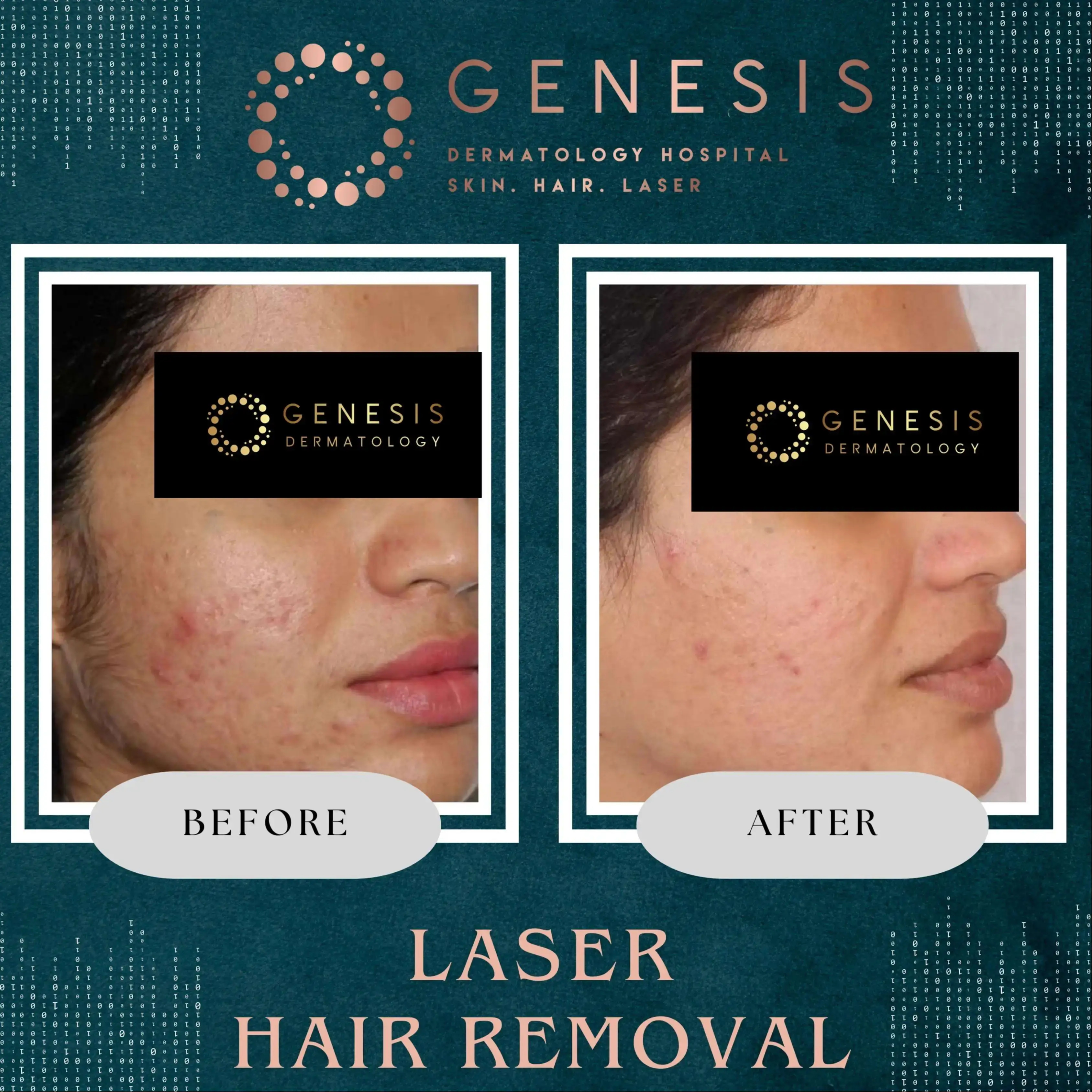 PRP Hair Treatment
