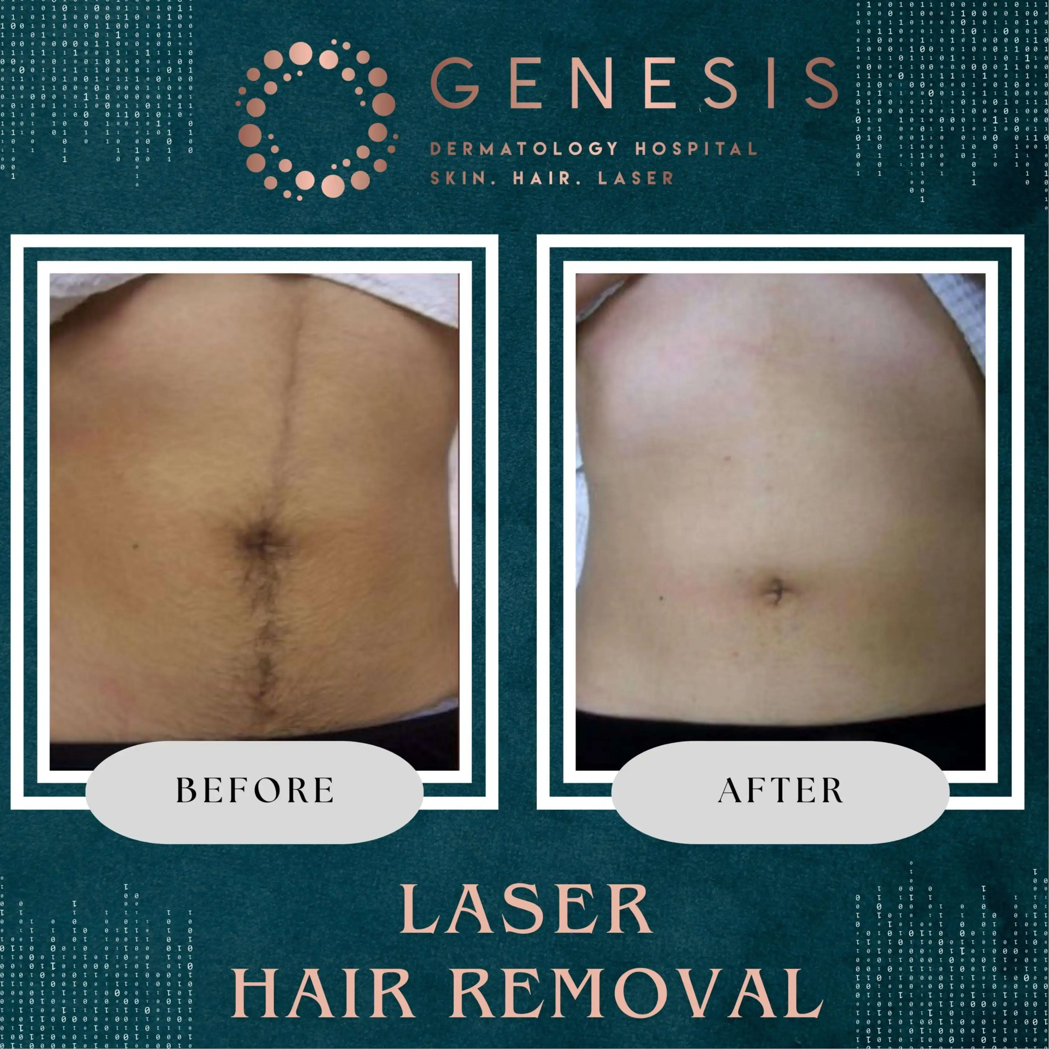 PRP Hair Treatment