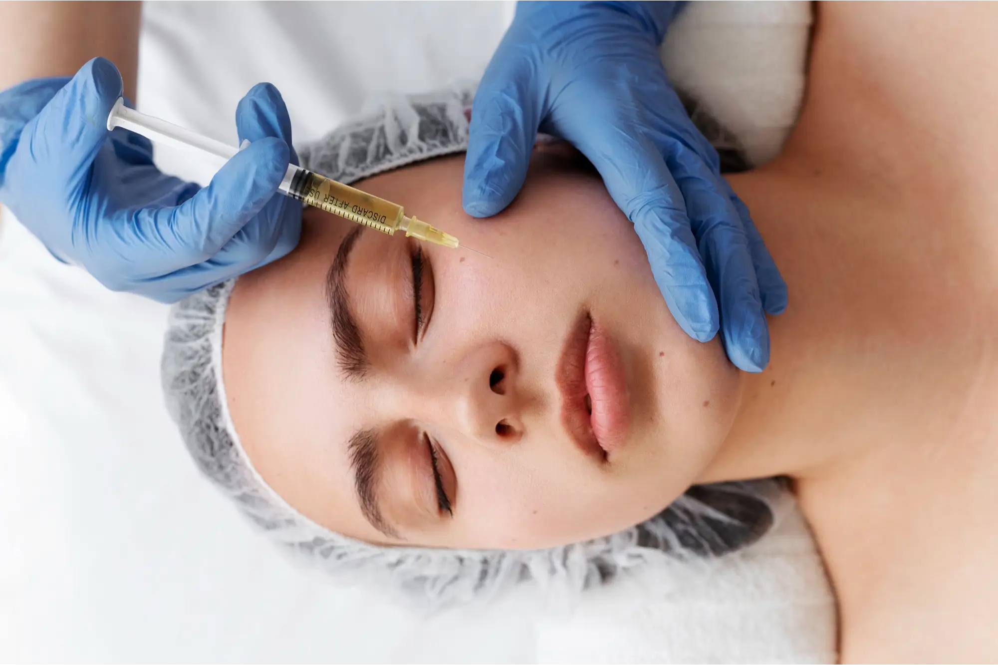 Botox Treatment