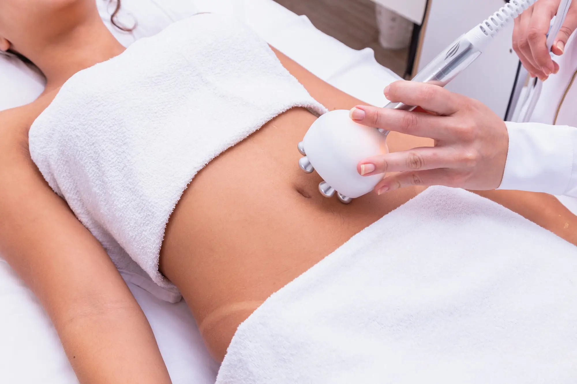 Stretch Marks Removal Treatment